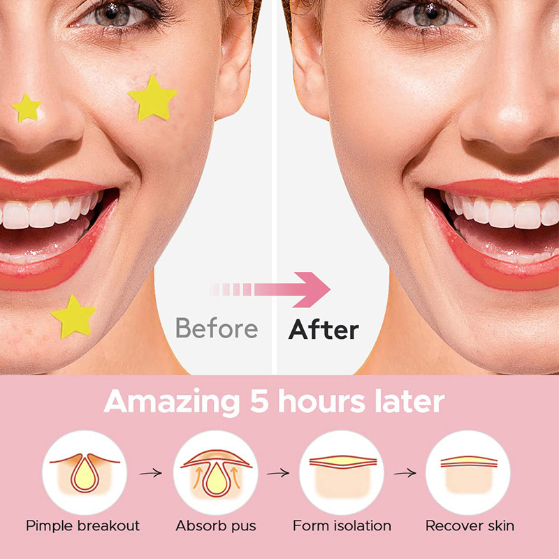 600 PCS/Set Star Pimple Patch  - огляд і ціна Beauty Makeup Face