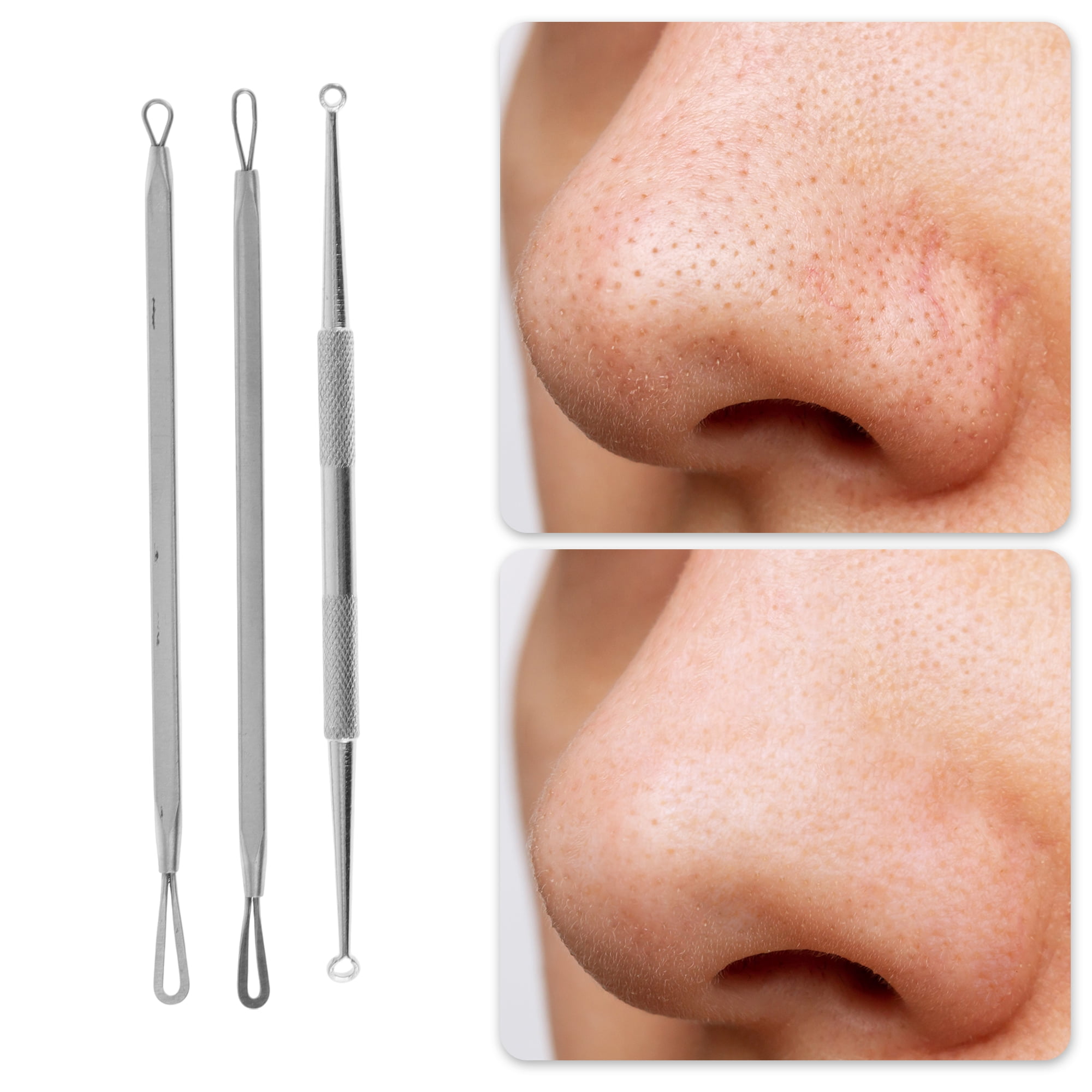 Professional Pimple Extractor  - огляд і ціна Beauty & Makeup Katia Di Paola